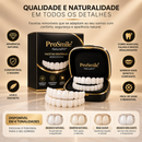 Facetas Dentária Ajustável Superior e Inferior