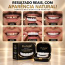 Facetas Dentária Ajustável Superior e Inferior