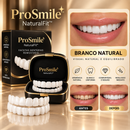 Facetas Dentária Ajustável Superior e Inferior