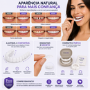 ProSmile NaturalFit™ — Faceta Dentária Ajustável