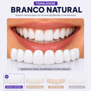 ProSmile NaturalFit™ — Faceta Dentária Ajustável